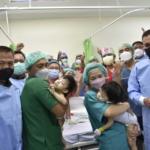 Sujud Syukur, Kembar Siam Joana Dan Jovalin Berhasil Dipisahkan