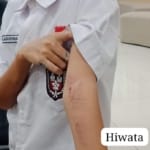 Injak Lantai Rumah Tetangga, Seorang Bocah Di Panunggangan Utara Alami Kekerasan