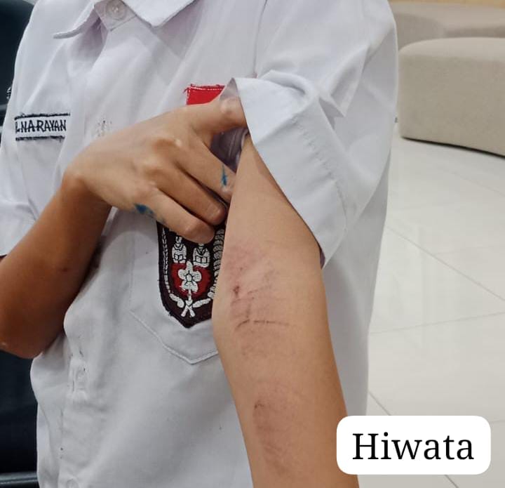 Injak Lantai Rumah Tetangga, Seorang Bocah Di Panunggangan Utara Alami Kekerasan 1 Injak Lantai Rumah Tetangga, Seorang Bocah Di Panunggangan Utara Alami Kekerasan