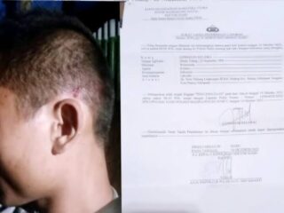 Pengurus Pusat Kerapatan Indonesia Tanah Air Desak Polri Usut Tuntas Kasus Penganiayaan Oleh Bos Tambang Ilegal Di Mandailing Natal