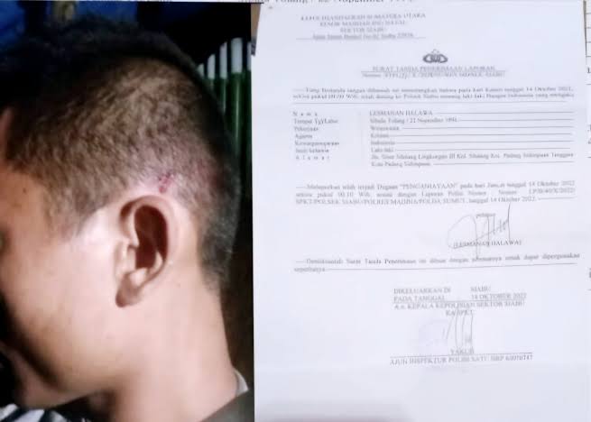 Pengurus Pusat Kerapatan Indonesia Tanah Air Desak Polri Usut Tuntas Kasus Penganiayaan Oleh Bos Tambang Ilegal Di Mandailing Natal 1 Mandailing Natal, 11 Mei 2025 – Pengurus Pusat Kerapatan Indonesia Tanah Air (Kita) Bidang Advokasi Publik Dan Keadilan Sosial, Mohamad Rohim, Menyoroti Lambannya Kinerja Kepolisian Republik Indonesia Dalam Menangani Kasus Penganiayaan Terhadap Warga Yang Dilakukan Oleh Bos Tambang Ilegal Di Desa Tangga Bosi Bukit Siayo, Kecamatan Siabu, Kabupaten Mandailing Natal. Menurut Rohim, Selama Tiga Tahun Terakhir, Aparat Penegak Hukum Belum Menunjukkan Tindakan Tegas Atas Laporan Penganiayaan Yang Menimpa Warga, Khususnya Lesmana Halawa, Korban Yang Telah Mengadu Sejak 2022. “Ini Menjadi Catatan Buruk Bagi Polri. Negara Harus Hadir Untuk Melindungi Rakyat, Bukan Membiarkan Warga Diteror Oleh Kekuatan Uang Dari Para Toke Tambang Ilegal,” Tegas Rohim. Ia Juga Mendesak Agar Polri Segera Bertindak Cepat Dan Menangkap Setidaknya 70 Bos Tambang Ilegal Yang Disebut-Sebut Masih Bebas Beroperasi Di Wilayah Tersebut. “Jangan Sampai Citra Polri Hancur Hanya Karena Tidak Berani Menghadapi Para Bos Tambang Yang Merusak Lingkungan Dan Menindas Rakyat Kecil,” Ujarnya. Lesmana Halawa, Salah Satu Korban, Mengungkapkan Bahwa Sejak Tiga Tahun Lalu Dirinya Telah Melaporkan Kasus Penganiayaan Yang Dialaminya Namun Belum Mendapatkan Keadilan. Mirisnya, Aktivitas Tambang Ilegal Masih Berlangsung Dengan Ratusan Lubang Yang Terus Digali. “Warga Yang Kritis Terhadap Tambang Ini Sering Diancam Bahkan Dikeroyok Seperti Saya,” Jelas Lesmana. Ia Juga Menyoroti Dugaan Keterlibatan Oknum Aparat Dalam Pembiaran Tambang Ilegal Tersebut. “Oknum Polisi Sering Naik Ke Lokasi Tambang, Bukan Untuk Menertibkan Tapi Malah Diduga Mengambil Setoran. Bayangkan Saja, Satu Lubang Bisa Menghasilkan Satu Kilogram Emas Per Minggu. Tak Heran Kasus Ini Mangkrak, Hukum Sekarang Seolah Jadi Mainan Orang Berduit,” Tutup Lesmana.