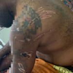 Seorang Tahanan Diduga Disiksa Oknum Polisi Polresta Sorong Kota