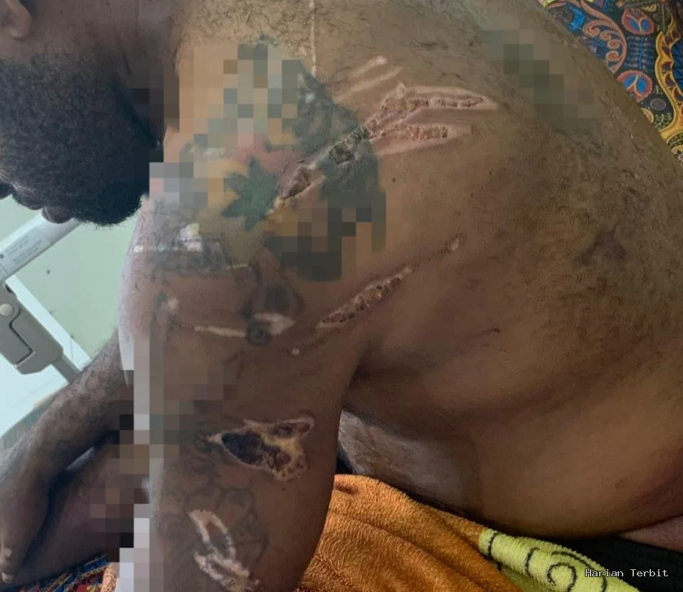 Seorang Tahanan Diduga Disiksa Oknum Polisi Polresta Sorong Kota