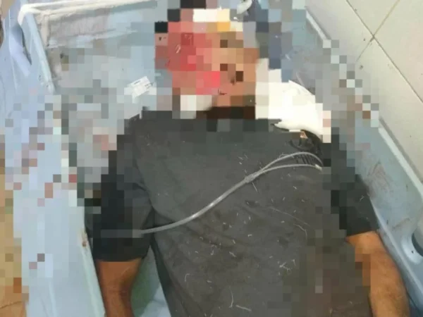 Polresta Sorong Kota Tegaskan Peristiwa Di Km 9 Murni Kecelakaan Lalu Lintas, Bukan Begal